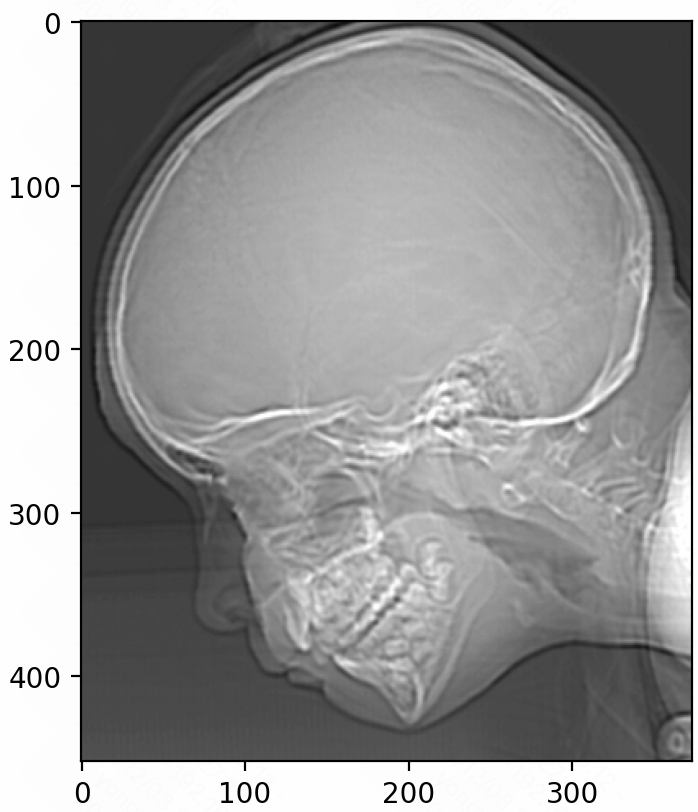 image-20241203232732722